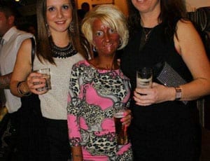 Picture of the week: Tanned out